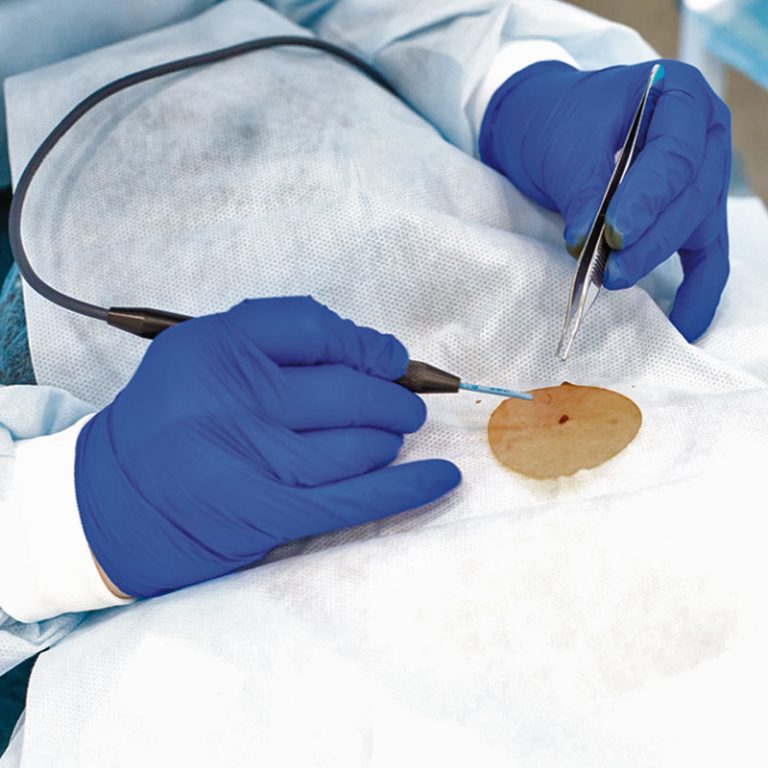 chirurgia-dermatologica