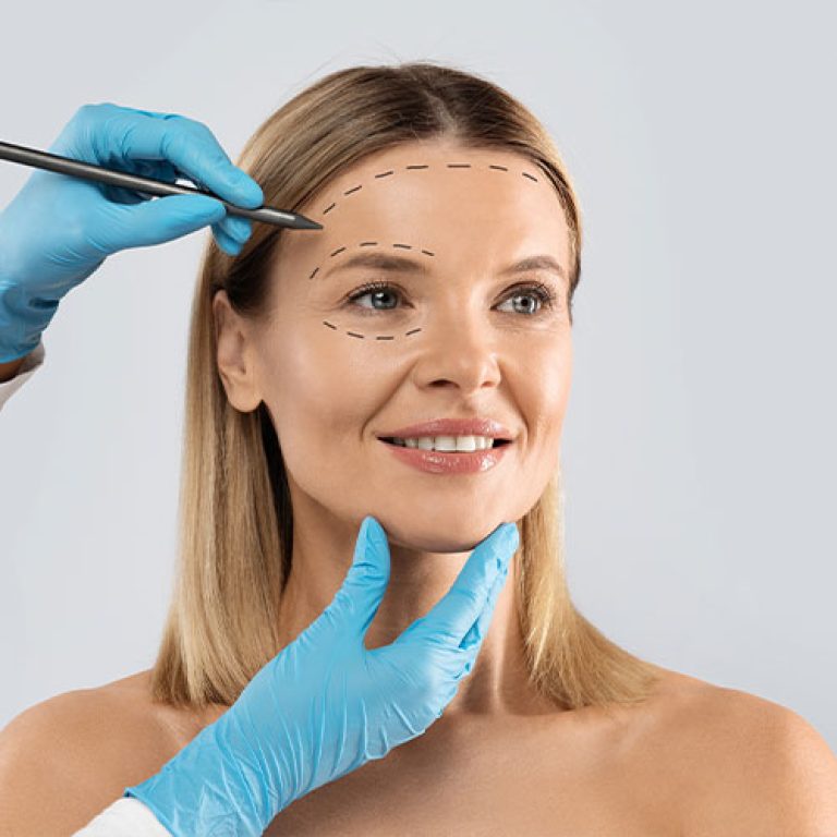 lifting-sopracciglio-01